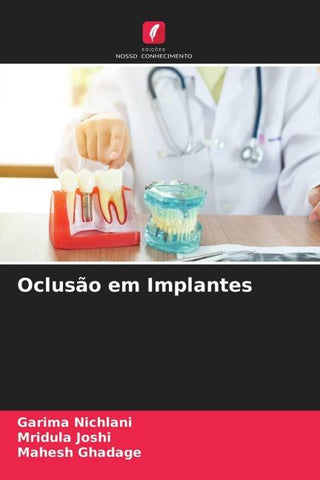 Oclusão em Implantes