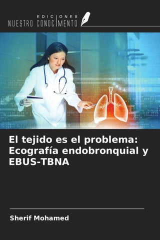 El tejido es el problema: Ecografía endobronquial y EBUS-TBNA