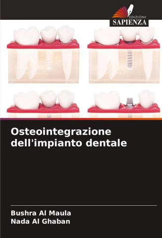 Osteointegrazione dell'impianto dentale