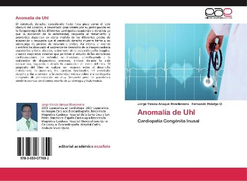 Anomalía de Uhl