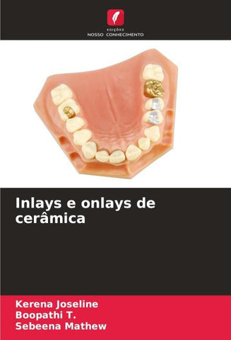 Inlays e onlays de cerâmica