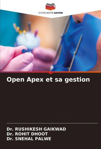Open Apex et sa gestion