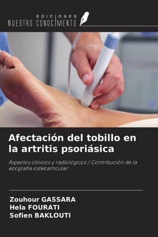 Afectación del tobillo en la artritis psoriásica
