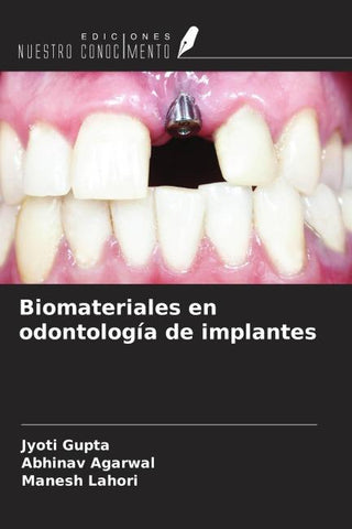 Biomateriales en odontología de implantes