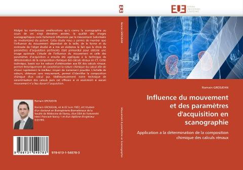 Influence du mouvement et des paramètres d''acquisition en scanographie