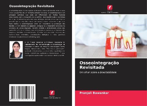 Osseointegração Revisitada