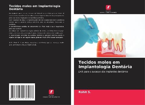 Tecidos moles em Implantologia Dentária