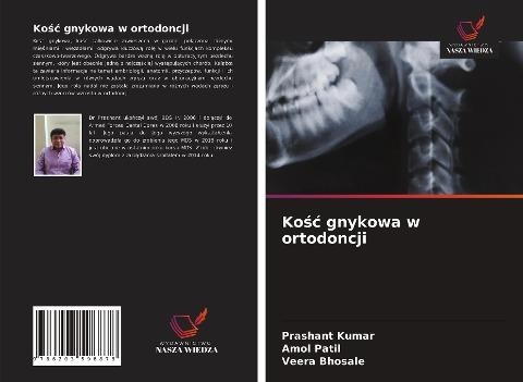 Ko¿¿ gnykowa w ortodoncji