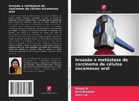 Invasão e metástase de carcinoma de células escamosas oral