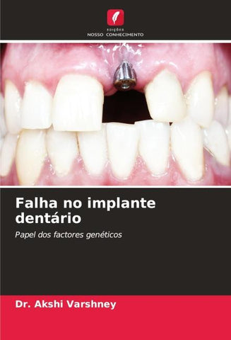Falha no implante dentário