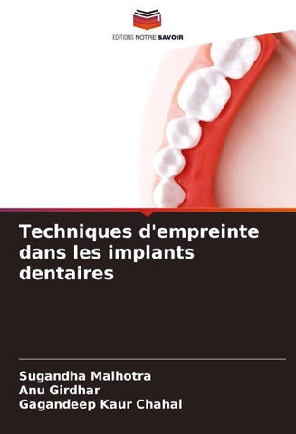 Techniques d'empreinte dans les implants dentaires