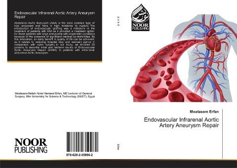 Endovascular Infrarenal Aortic Artery Aneurysm Repair