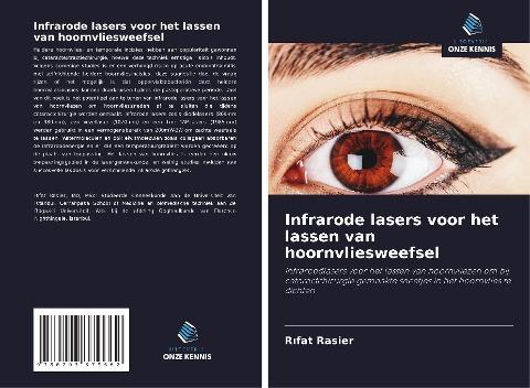 Infrarode lasers voor het lassen van hoornvliesweefsel