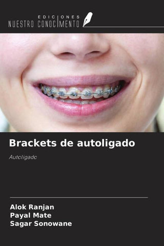 Brackets de autoligado