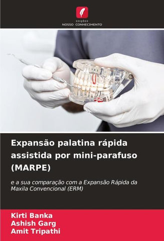 Expansão palatina rápida assistida por mini-parafuso (MARPE)