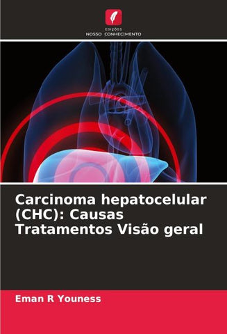 Carcinoma hepatocelular (CHC): Causas Tratamentos Visão geral