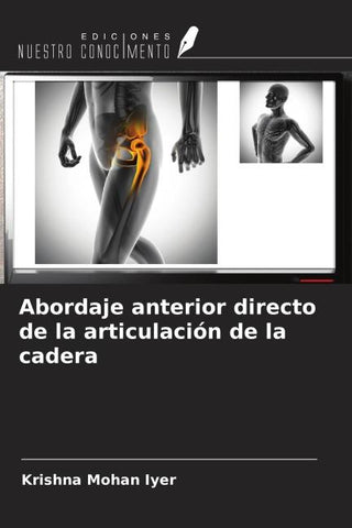 Abordaje anterior directo de la articulación de la cadera