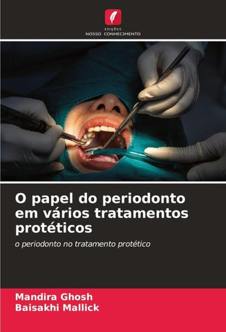 O papel do periodonto em vários tratamentos protéticos