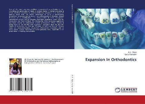 Expansion In Orthodontics