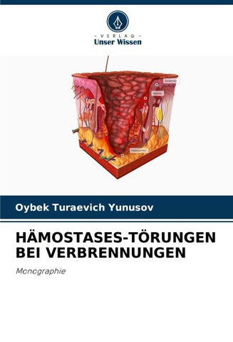 HÄMOSTASES-TÖRUNGEN BEI VERBRENNUNGEN