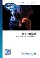 Hip implant