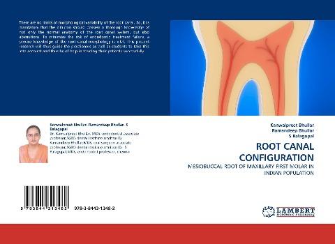 ROOT CANAL CONFIGURATION