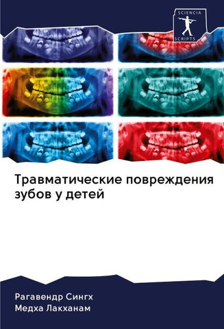 Trawmaticheskie powrezhdeniq zubow u detej