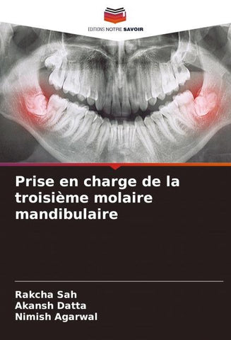 Prise en charge de la troisième molaire mandibulaire