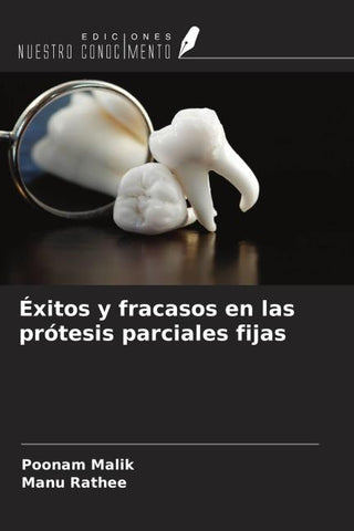 Éxitos y fracasos en las prótesis parciales fijas