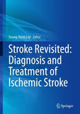Stroke Revisited: Diagnosis and Treatment of Ischemic Stroke