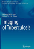 Imaging of Tuberculosis
