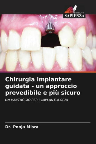 Chirurgia implantare guidata - un approccio prevedibile e più sicuro
