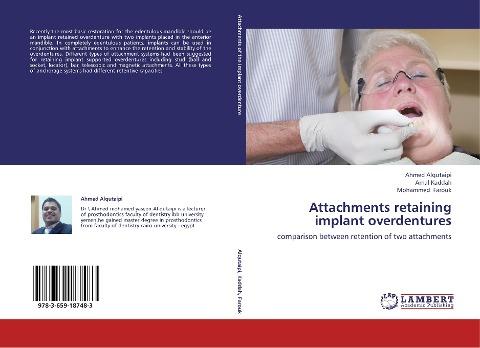 Attachments retaining implant overdentures