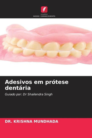 Adesivos em prótese dentária