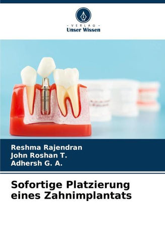Sofortige Platzierung eines Zahnimplantats