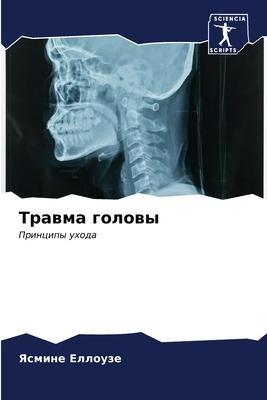 Trawma golowy