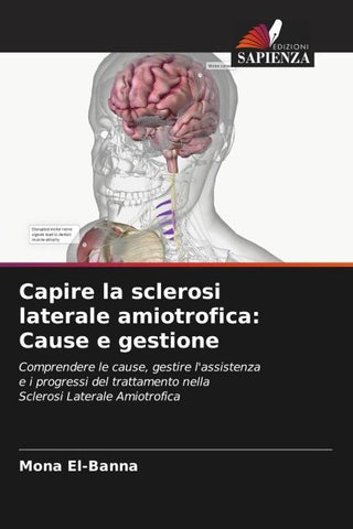 Capire la sclerosi laterale amiotrofica: Cause e gestione
