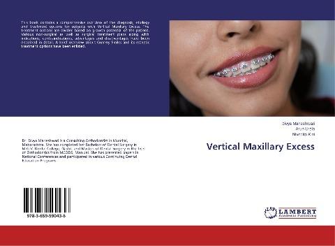 Vertical Maxillary Excess