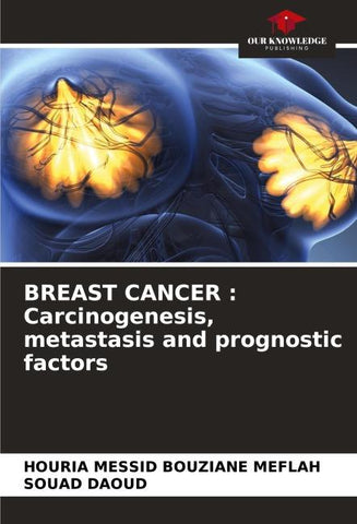 BREAST CANCER : Carcinogenesis, metastasis and prognostic factors