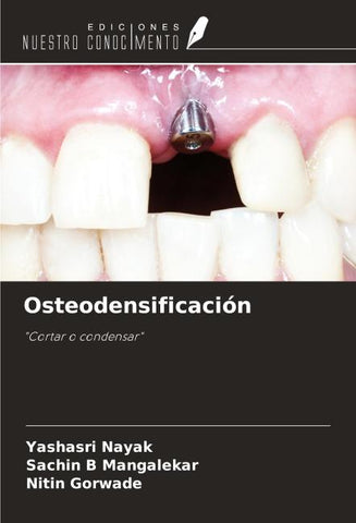 Osteodensificación