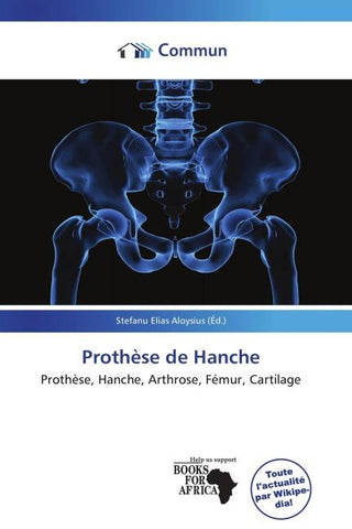 Prothèse de Hanche