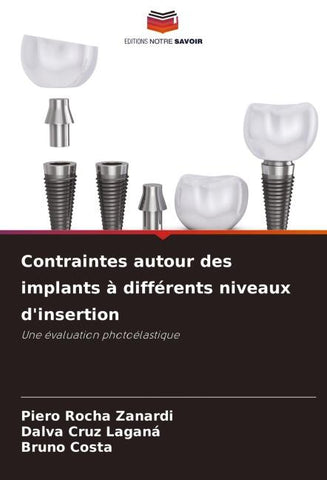 Contraintes autour des implants à différents niveaux d'insertion