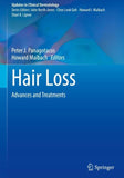 Hair Loss