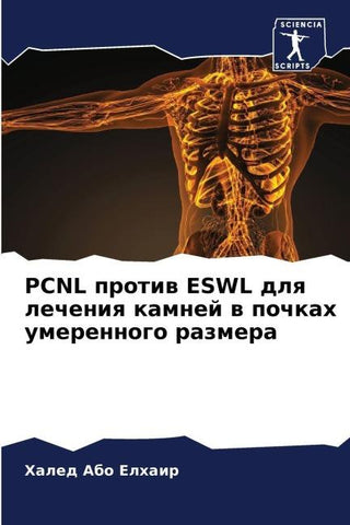 PCNL protiw ESWL dlq lecheniq kamnej w pochkah umerennogo razmera