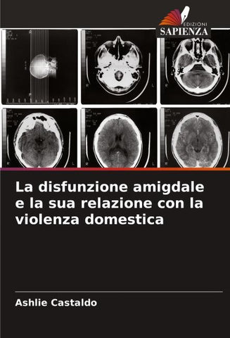 La disfunzione amigdale e la sua relazione con la violenza domestica