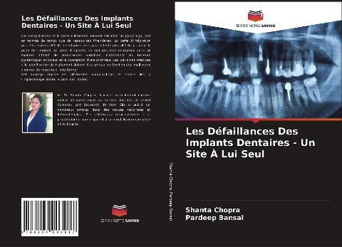 Les Défaillances Des Implants Dentaires - Un Site À Lui Seul