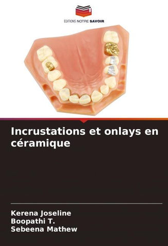 Incrustations et onlays en céramique