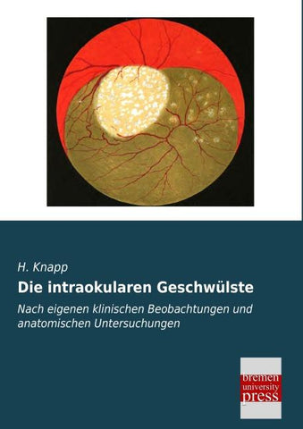 Die intraokularen Geschwülste