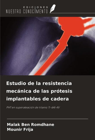 Estudio de la resistencia mecánica de las prótesis implantables de cadera