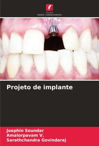 Projeto de implante